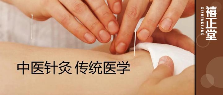 进针、行针、留针、出针详解 - 知乎