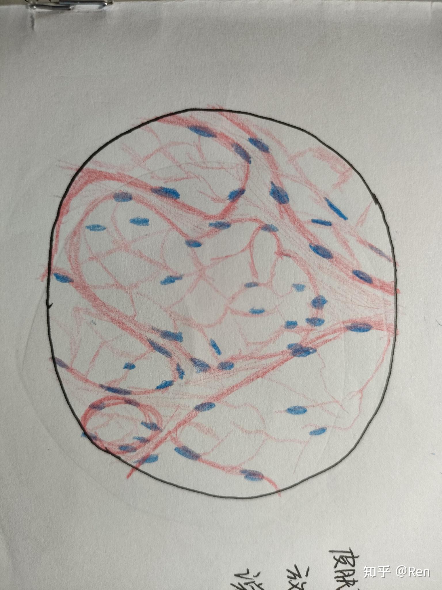 癌红蓝铅笔手绘图图片