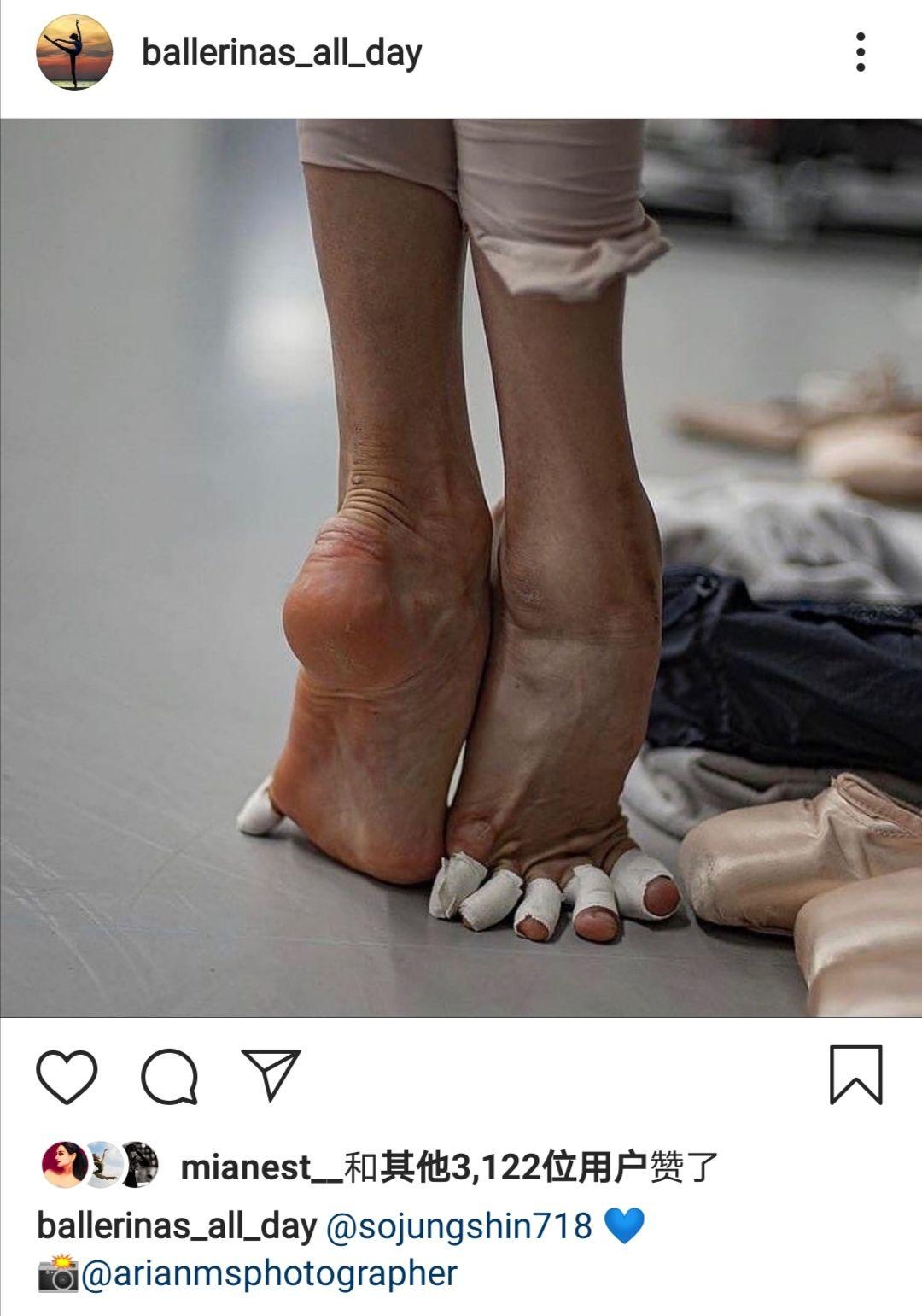 芭蕾舞演员的脚会变成什么样？ - 知乎