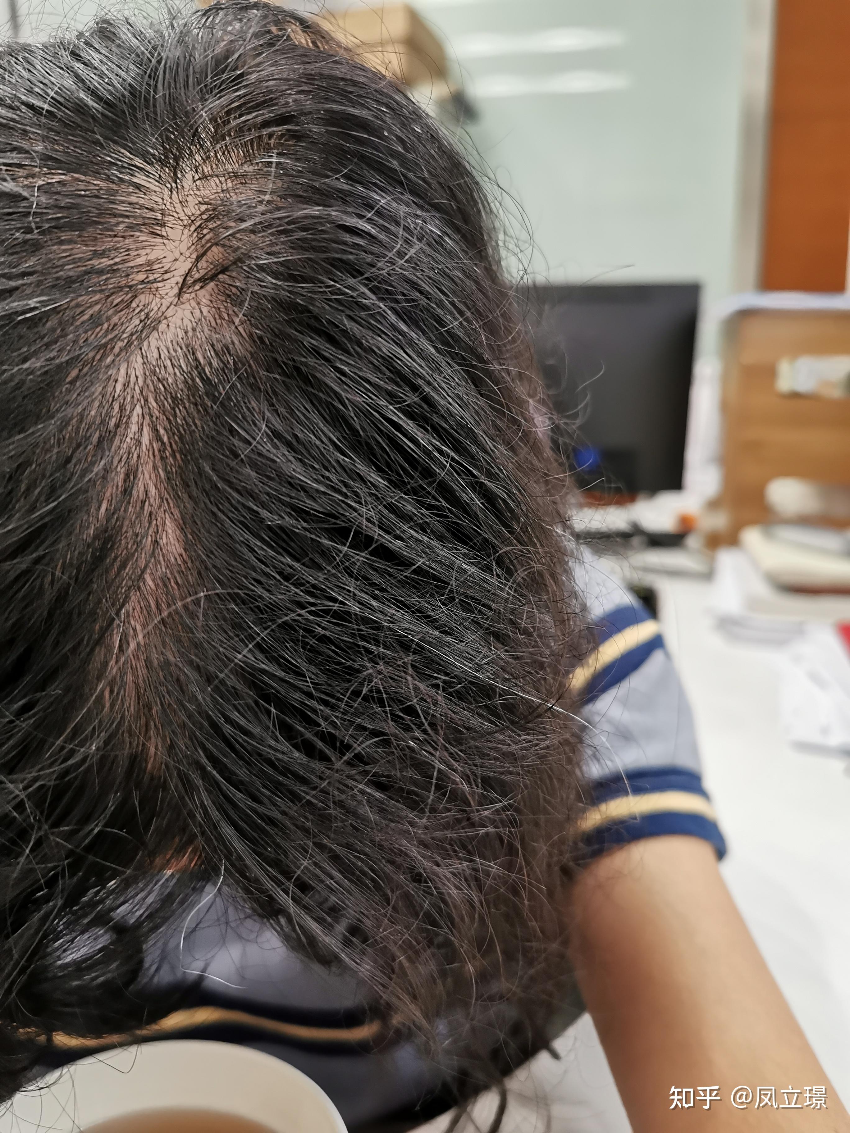 每天随手拍张照片记录下哈,慢慢期待改变我已经再幻想我变成长发公主