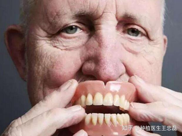 家里老人要镶全口活动假牙 剩余几颗牙根必须拔掉吗 知乎