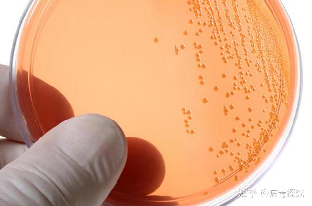 硝化细菌硫化细菌铁细菌氢细菌对农业生产和环境有什么影响