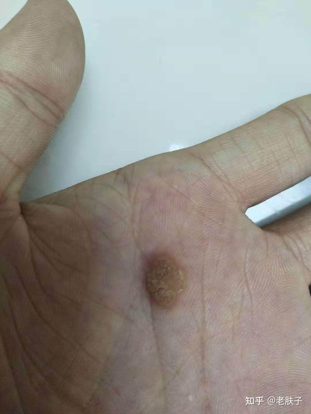 我手指头上长得是什么东西大神给看看呗