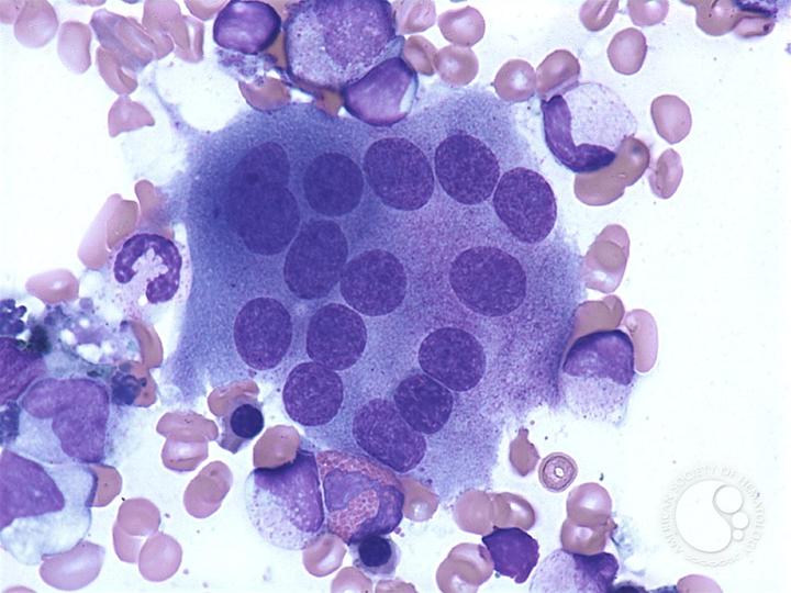 破骨细胞培养及相关细胞因子