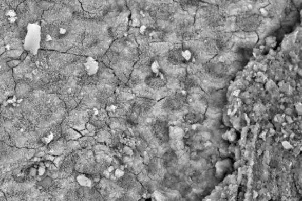 头皮屑多到一挠就跟下雪一样,怎么办? - 知乎