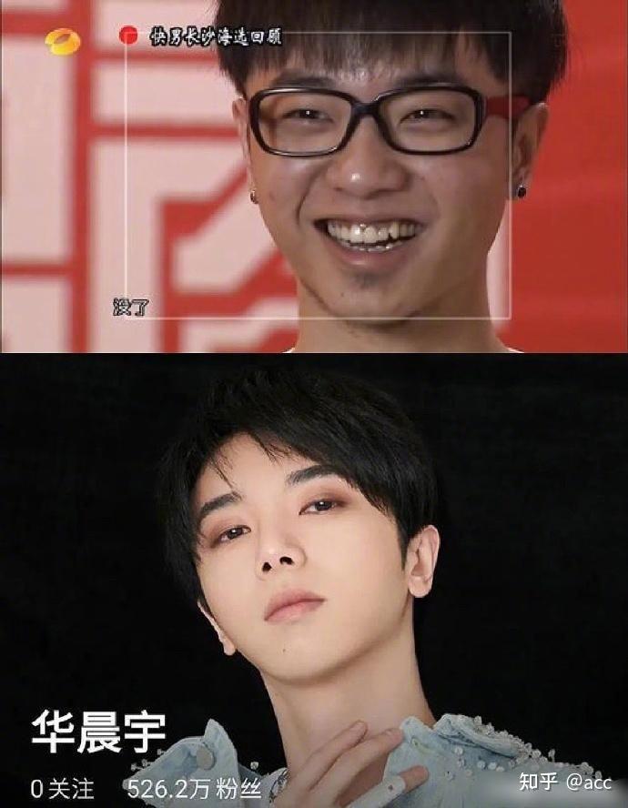 如何看待关于华晨宇整容的爆料