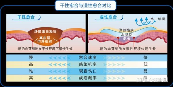 不想留疤?三分钟学会的湿性愈合操作教程 - 知乎