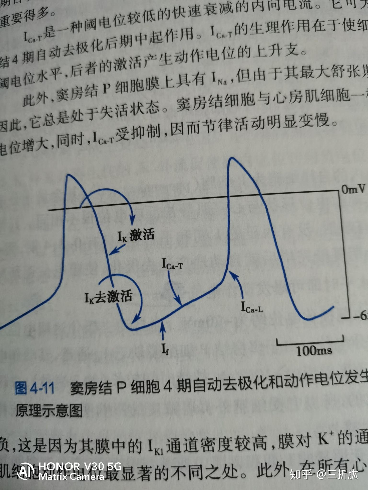 心肌细胞动作电位与神经纤维动作电位在波形上有什么区别? - 知乎