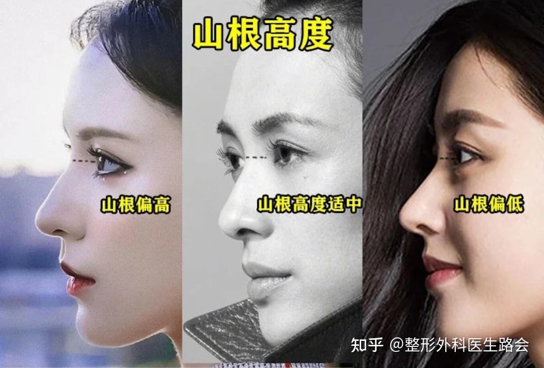 直鼻,翹鼻,微駝峰,好看的鼻子怎麼選? - 知乎