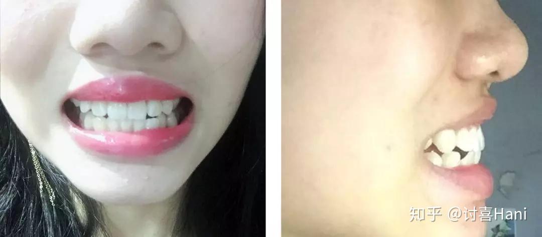 啥叫五官轮廓好 v2-abd4f7fc8167a3cb188e6e8cdc77c68f_r.jpg