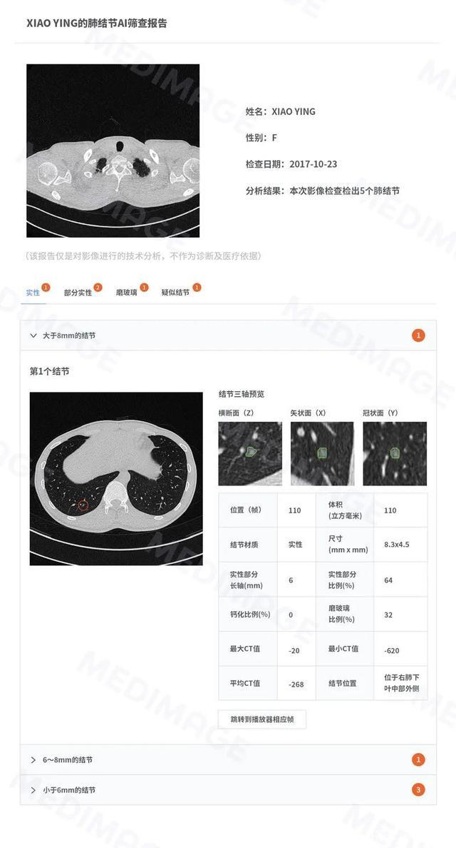 关于肺结节测量不得不知的二三事