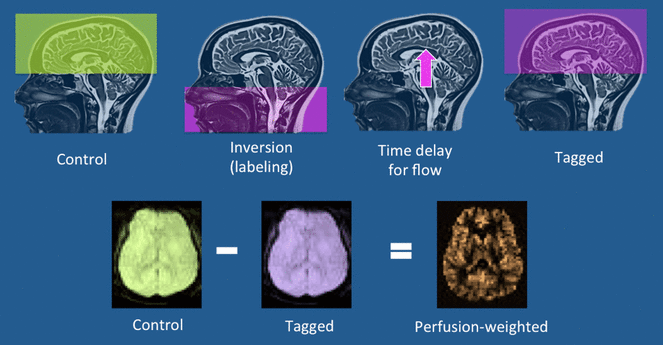 脑灌注压计算公式 zhuanlan.zhihu.com