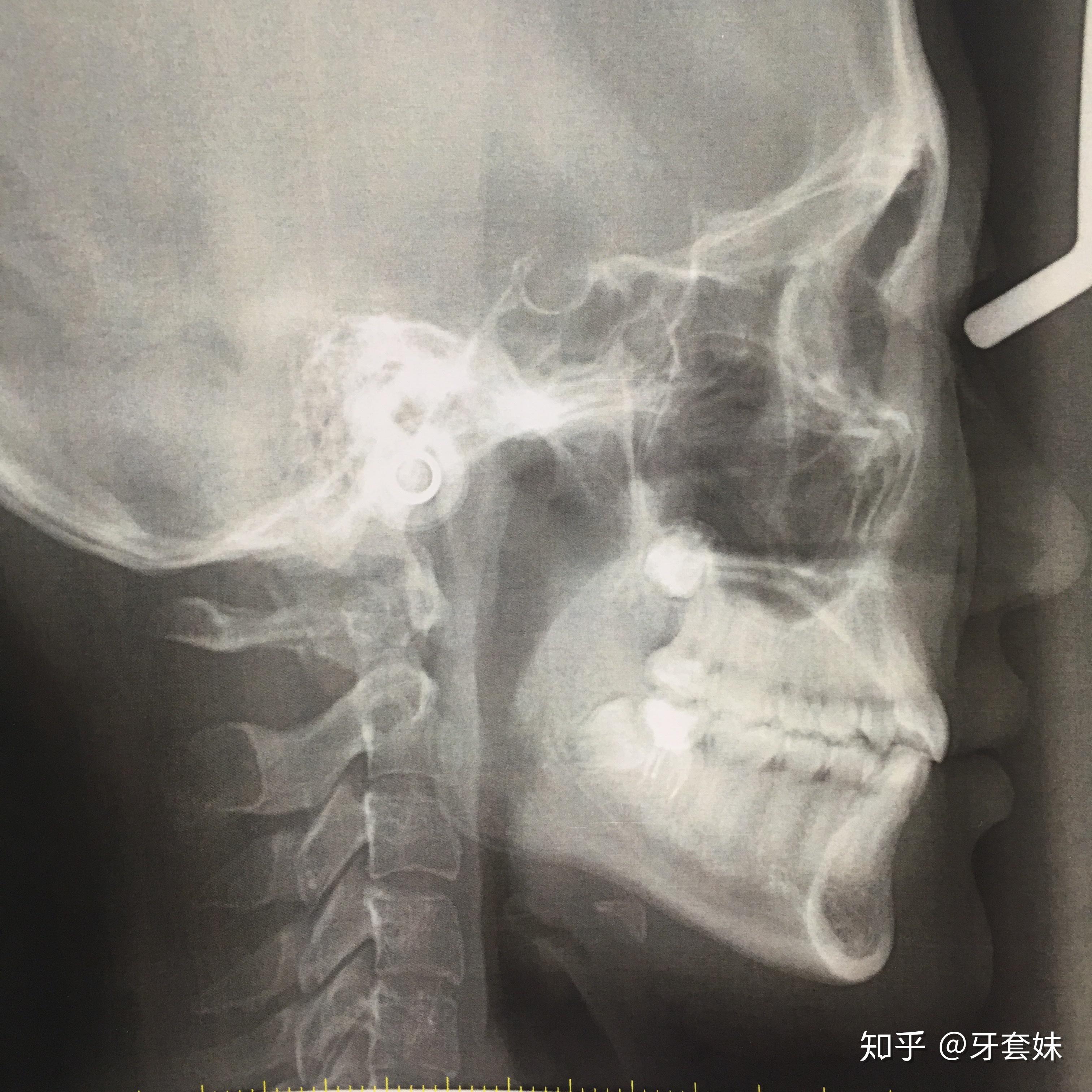 v2-abe820a61db542291e6d9a9bab617ed4_r.jpg