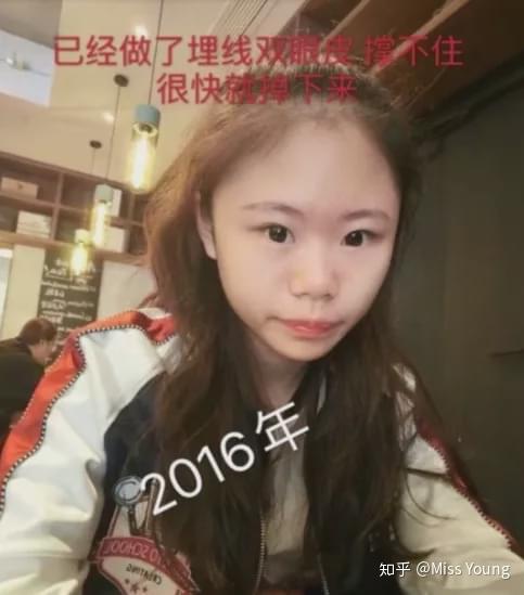 整容失败有多可怕