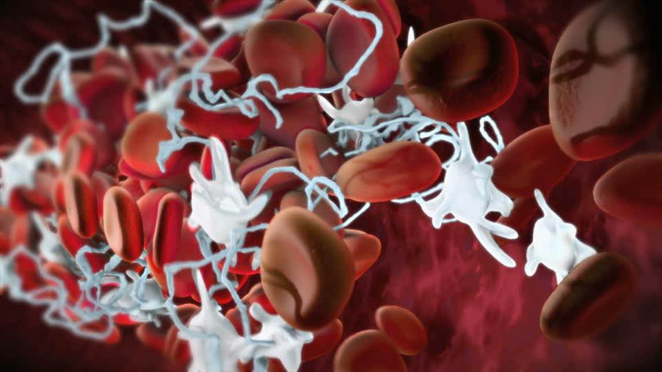 什么叫原发性血小板增多症 v2-ac2075a72babf3d86484d11f740c6e23_1440w.jpg?source=172ae18b