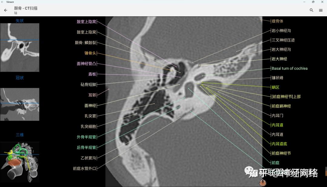 舌下腺ct断层解剖图图片