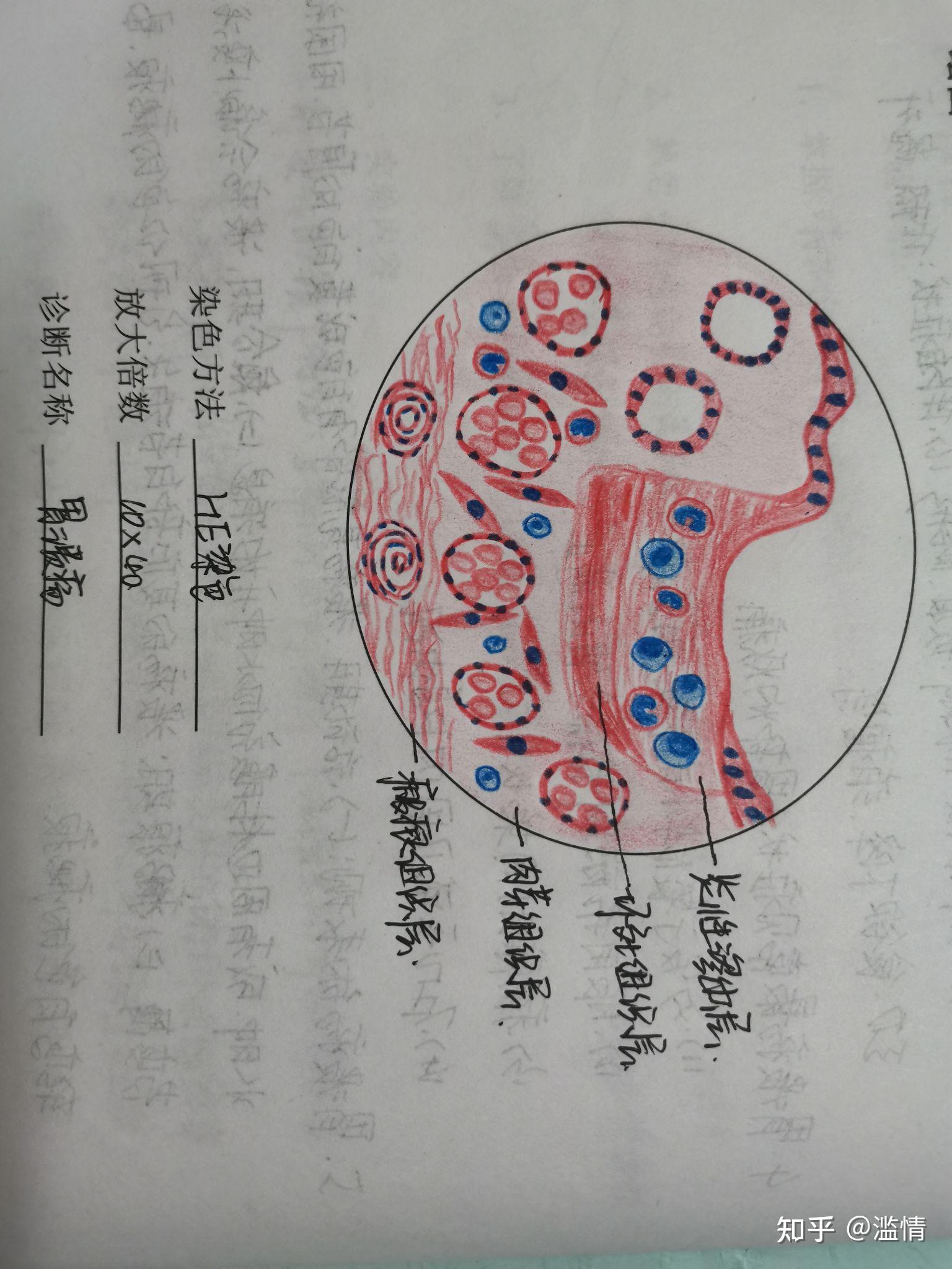肉桂油细胞手绘图图片