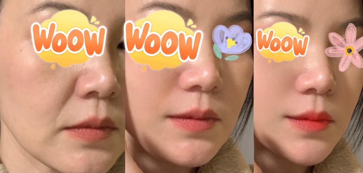 之前我的"三八线"深得能插秧,坚持用初普的这段时间,不管是笑纹还是