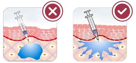 什么叫做安全注射 v2-acaca02e9808a4bfadf001fe0c9bc960_1440w.jpg?source=172ae18b