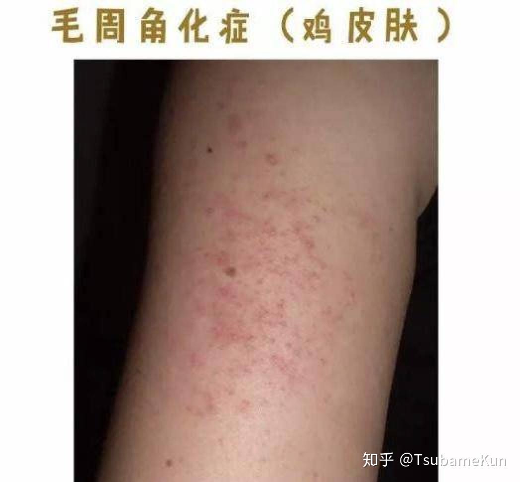 包含用unlike有点鸡皮肤了的词条