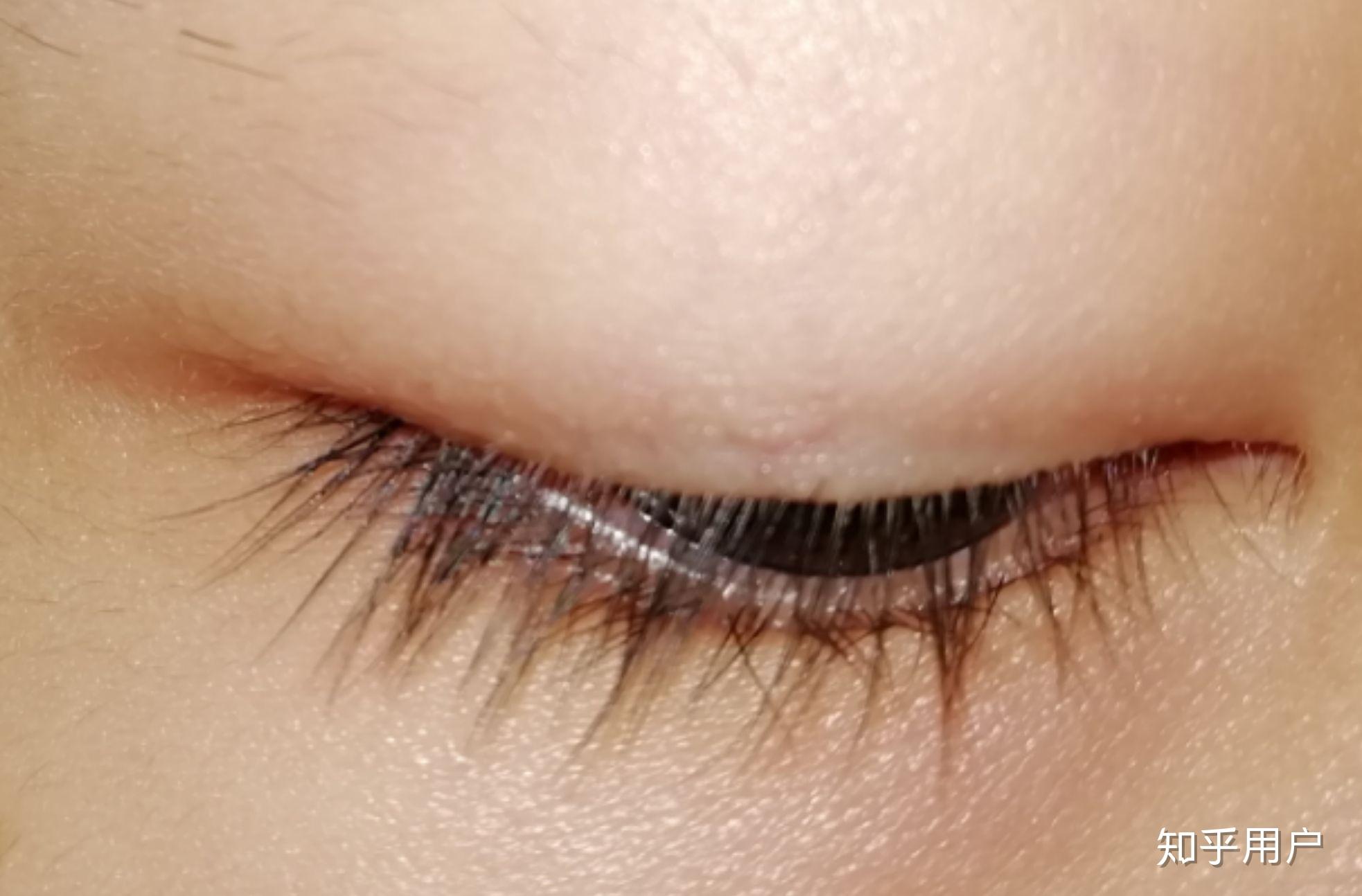 有一单一双的眼睛是啥样