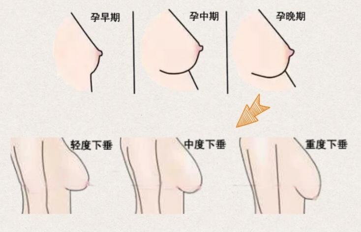 大家穿什么品牌的哺乳内衣?哺乐多哺乳内衣好么?
