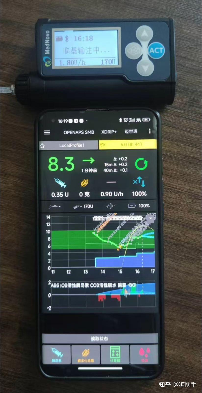 《匠心守护,精准赋能——中国自主研发的迈世通胰岛素泵品牌深度解析》 - 知乎