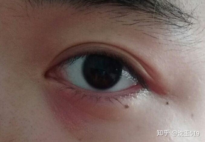 有什么含义?这颗痣好不好?眼睛属于桃花眼吗?