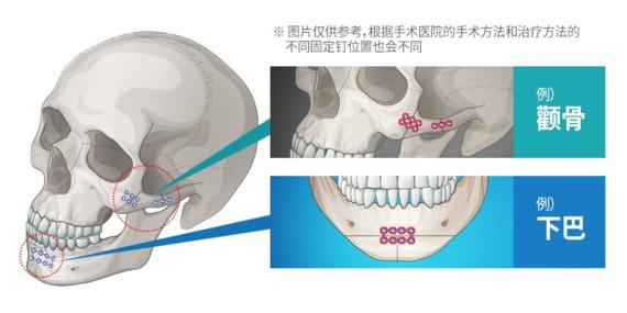 v2-ad3397a99715604ae7e12204c8c40c20_1440w.jpg?source=172ae18b