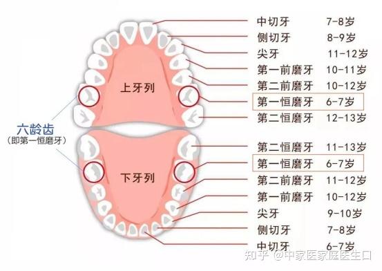 為什麼六齡齒更容易蛀牙