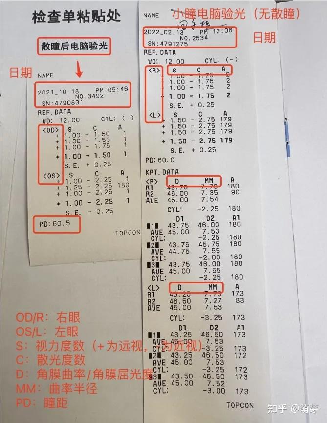 请问有人会看视力检查表么?