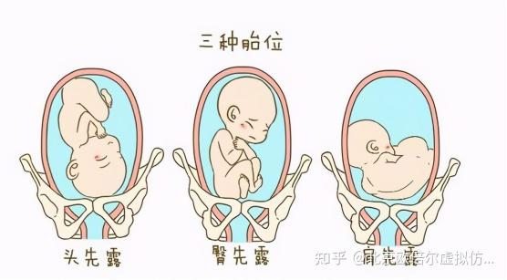 妇产科护理学虚拟仿真软件带你了解持续性枕横位分娩机制 - 知乎