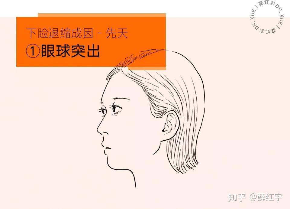 三白眼怎么办? - 知乎