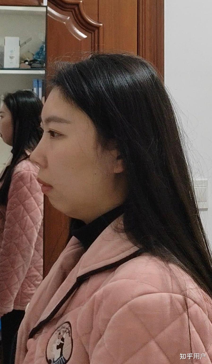 22岁下巴短几乎无下巴怎么办? - 知乎