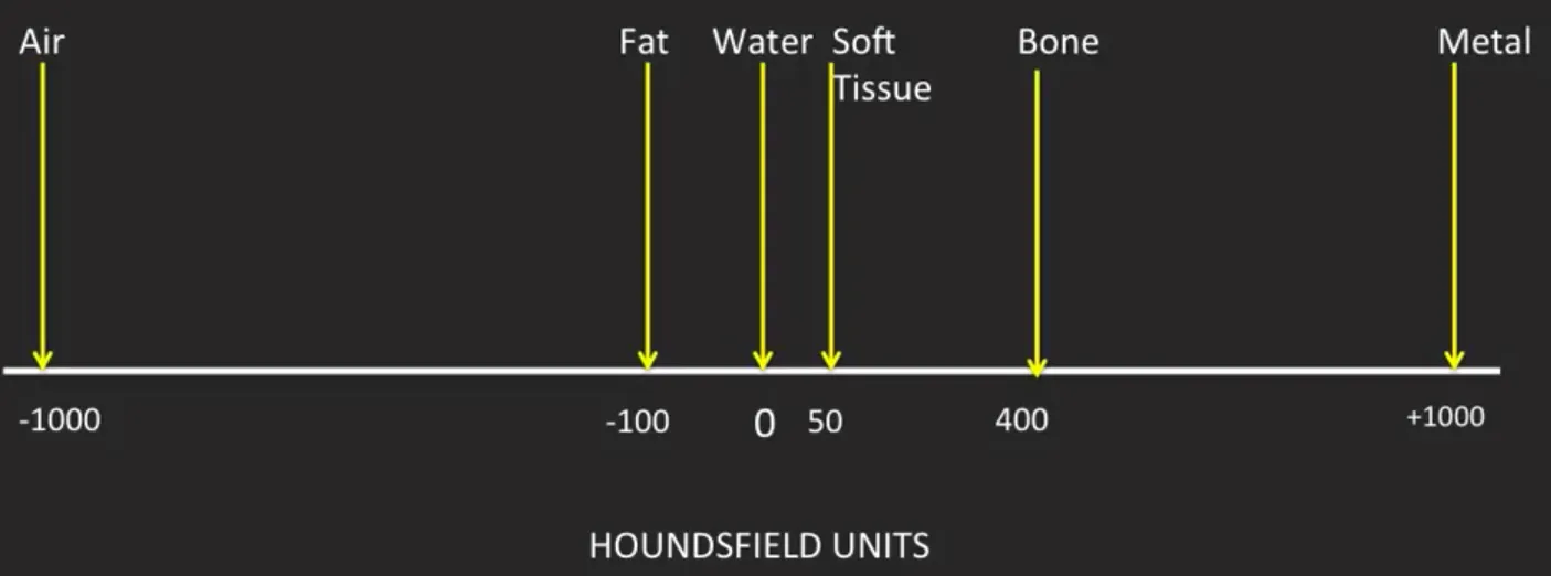 CT-Windowing医学CT图像增强 - 知乎