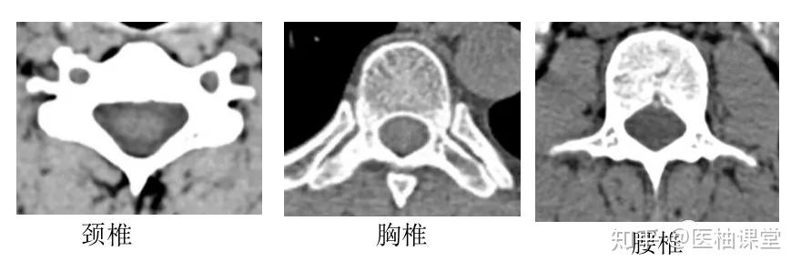 脊柱超详细解剖,高清图文版 - 知乎