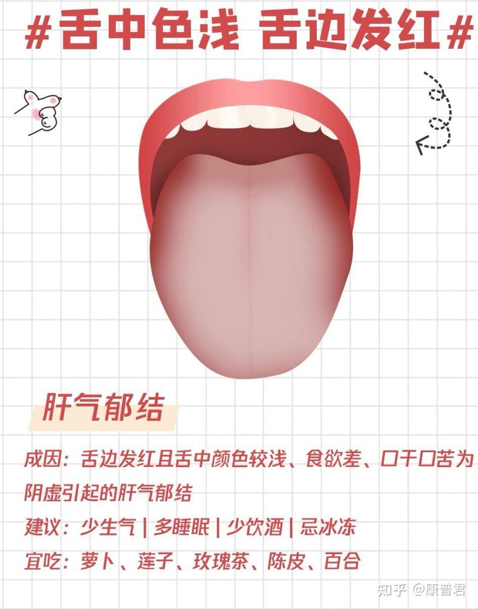 一张图让你简单看懂中医舌诊!