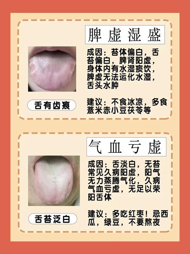 6种常见舌象,对照一下自己 - 知乎