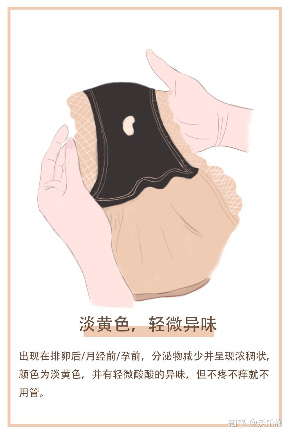 内裤上总是有东西怎么办?这5种颜色需要注意了!