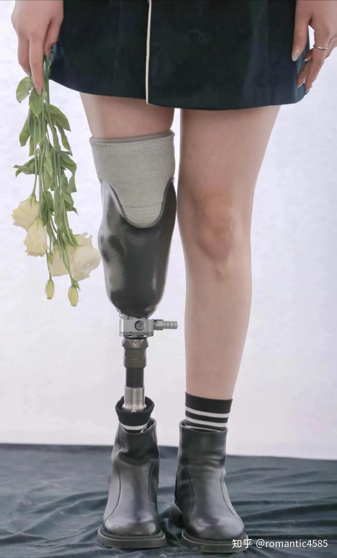 截肢后的主要功能障碍及治疗方法_优邦假肢矫形器上海有限公司_新浪博客