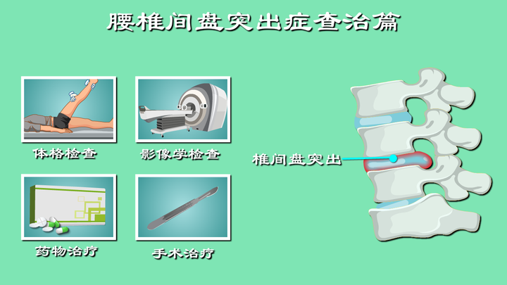 腰椎间盘突出怎么办？推拿？按摩？还是开刀？细数治疗腰突那些招 知乎