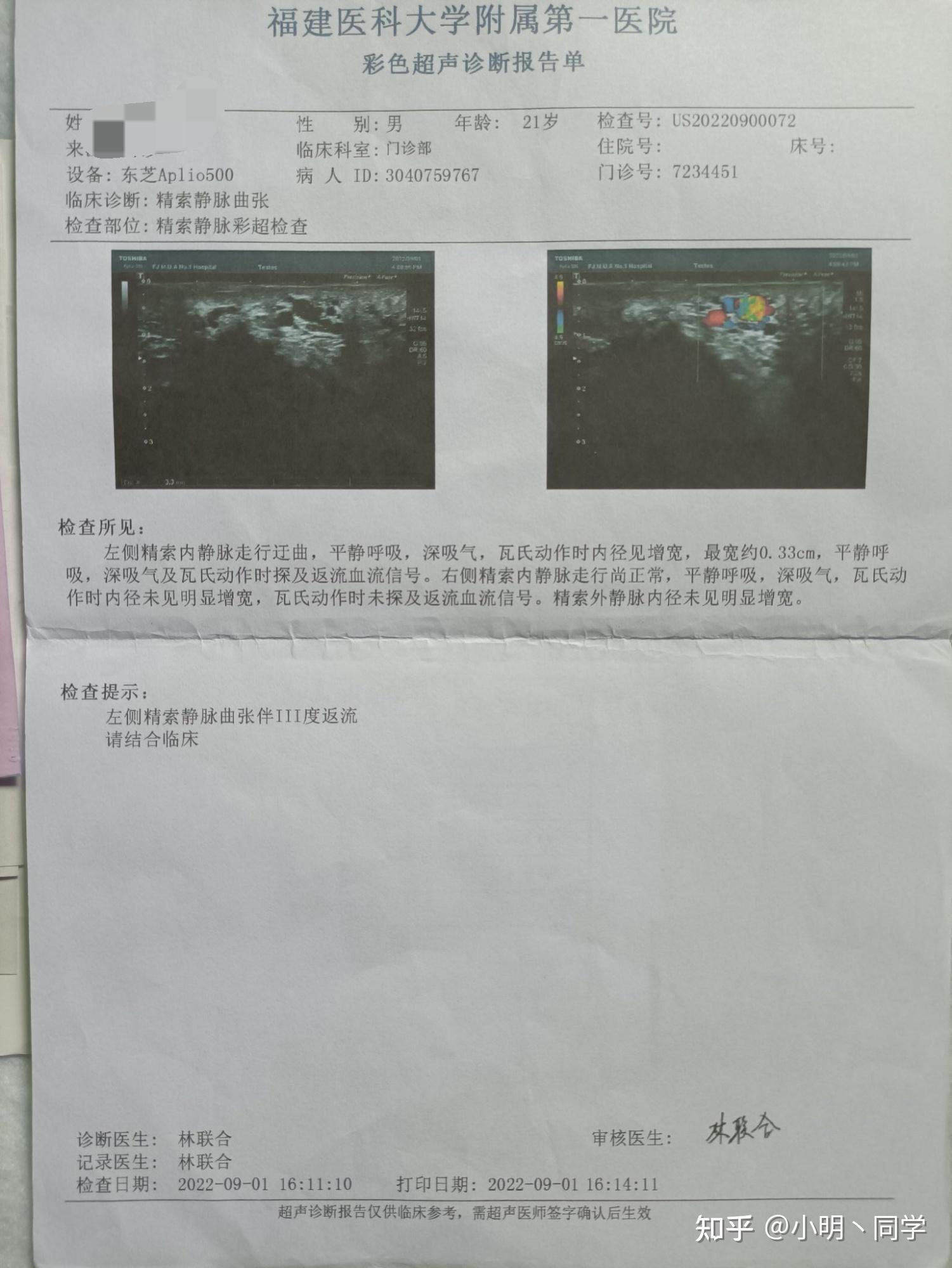 前列腺正常彩超图图片