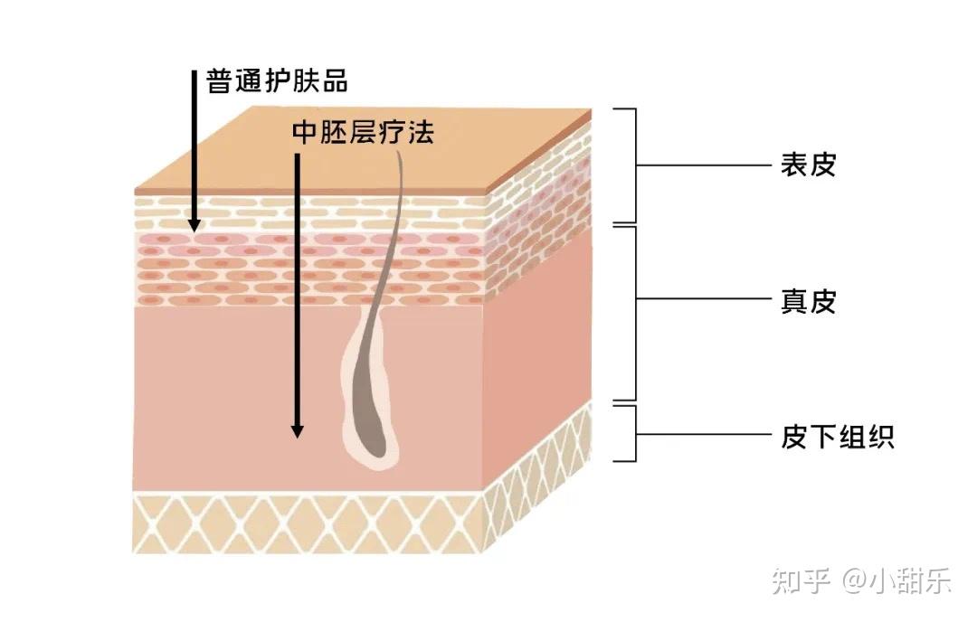 皮肤结构 中胚层图片