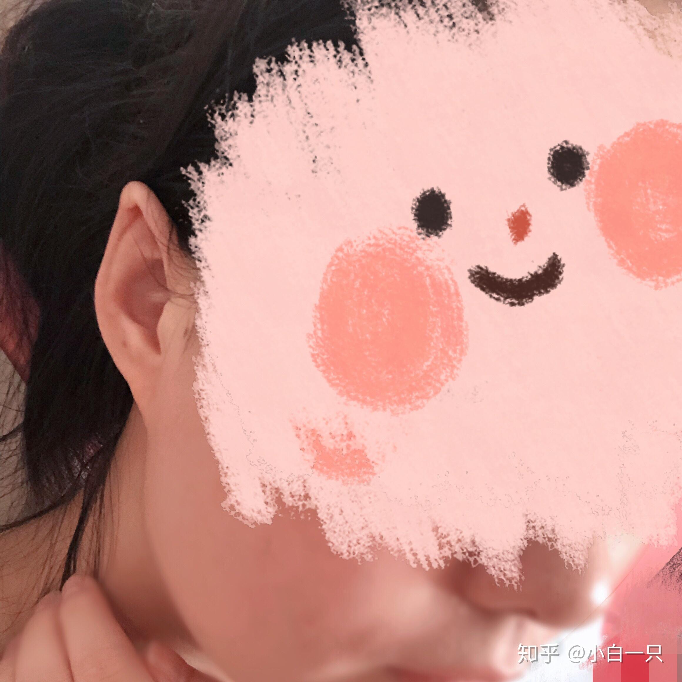 耳朵上端是尖的像精灵一样,是反古现象吗? - 知乎