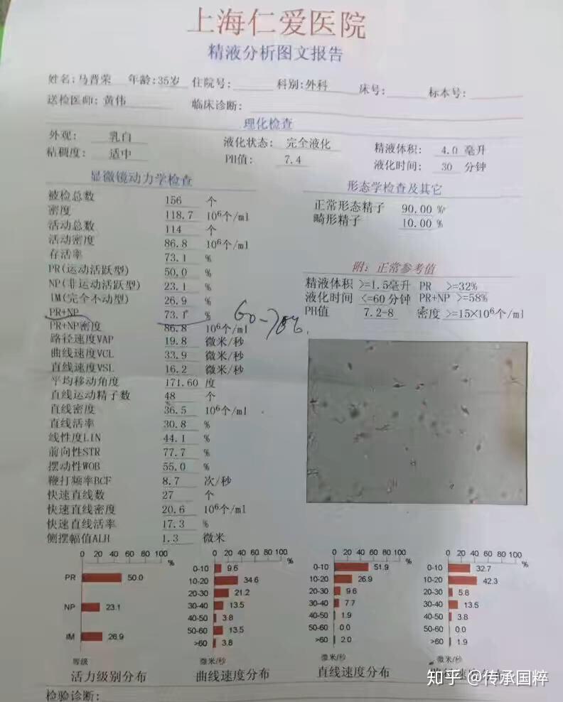 婚后5年未育死精患者终痊愈