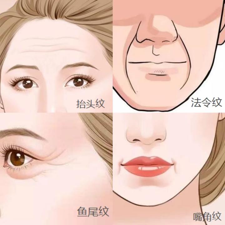 常见的皱纹类型和改善~ - 知乎