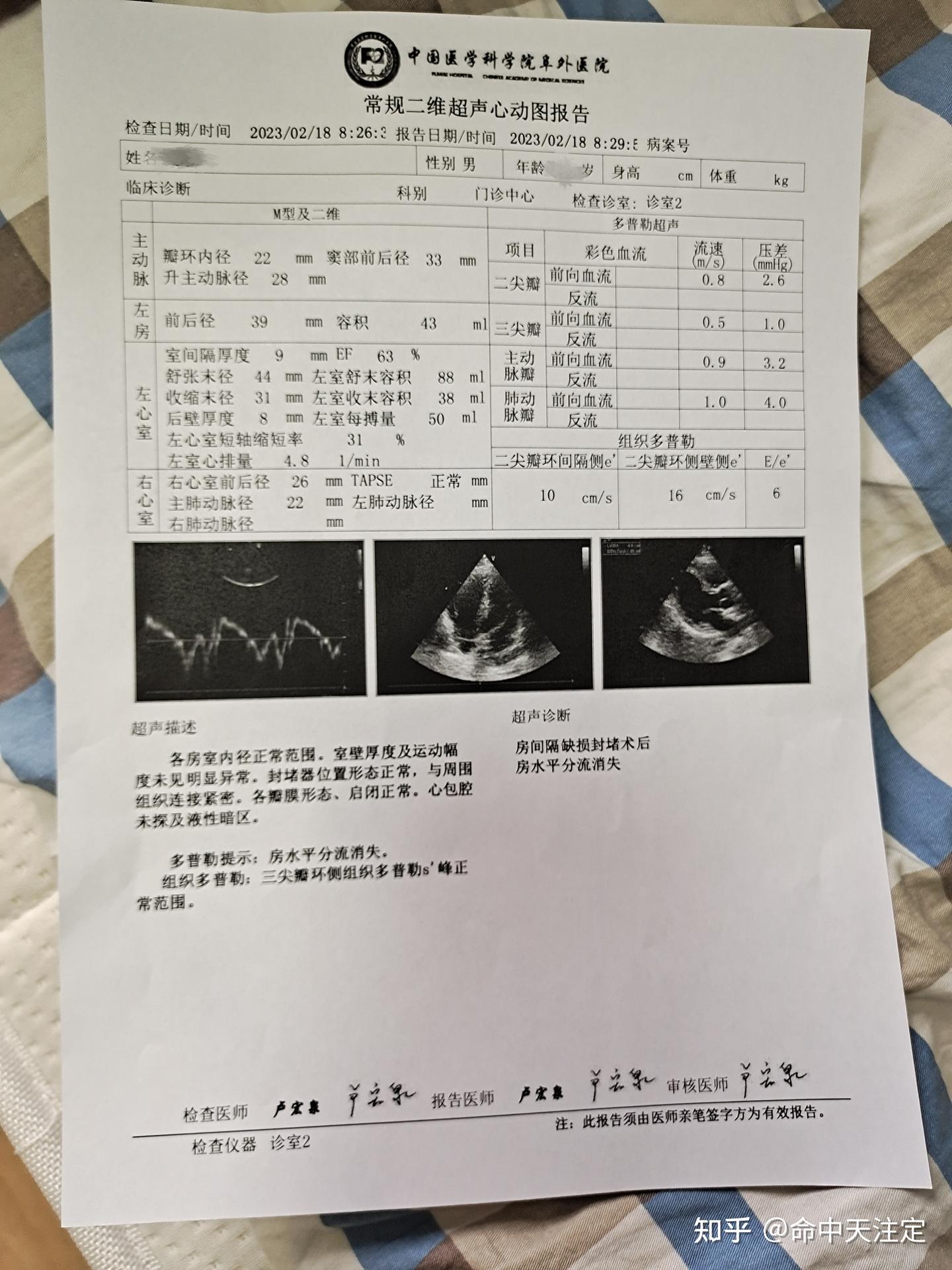 不知不觉房间隔介入术后已经4年7个月了 - 知乎
