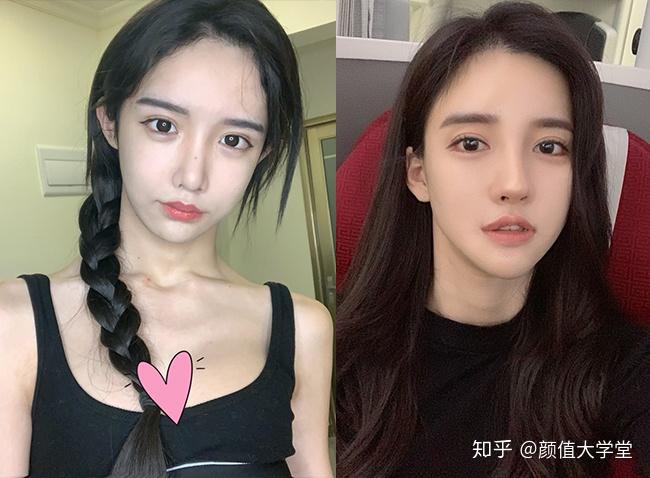 女装大佬艾比abbily撞脸潘南奎科普网红流水线整容的致命弊端