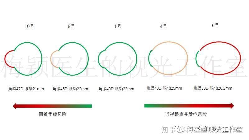 医生,请问孩子近视200度带150度散光,能戴角膜塑形吗?