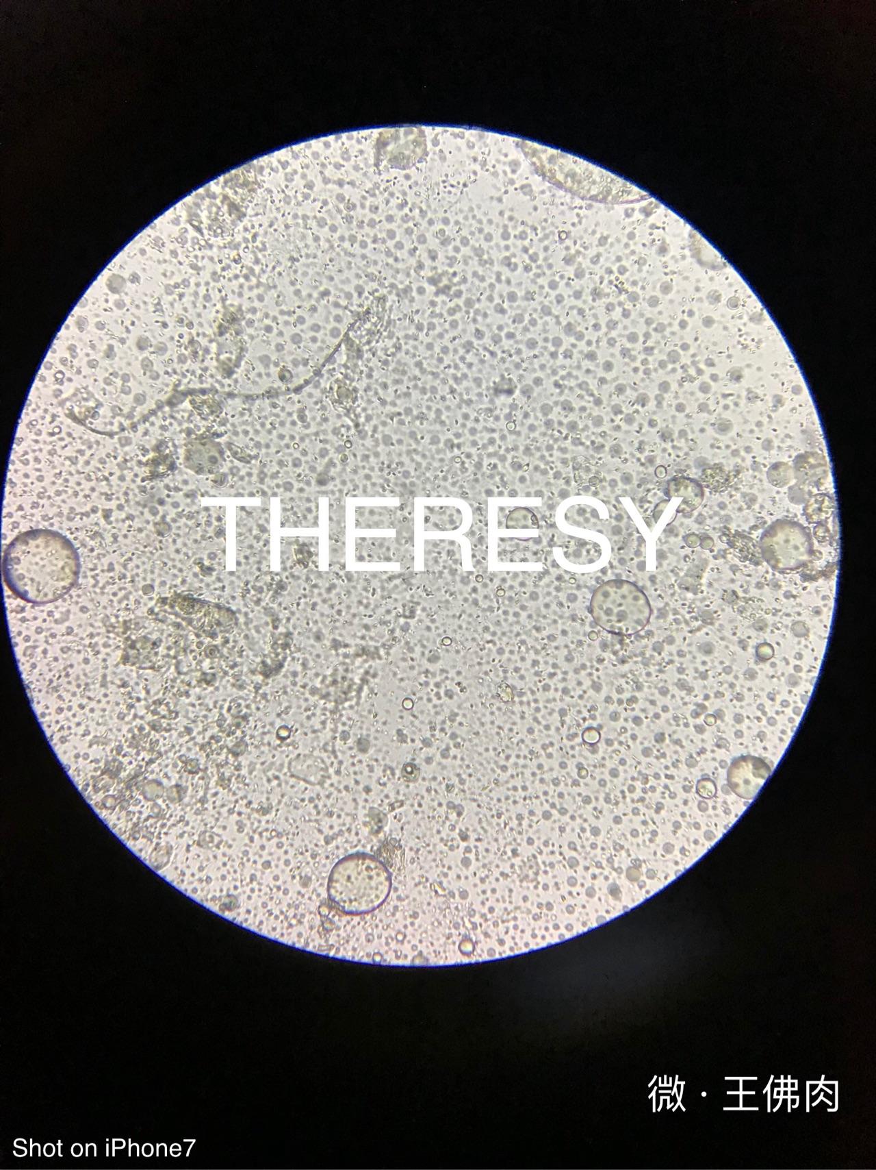 显微镜 精子标本制作图片